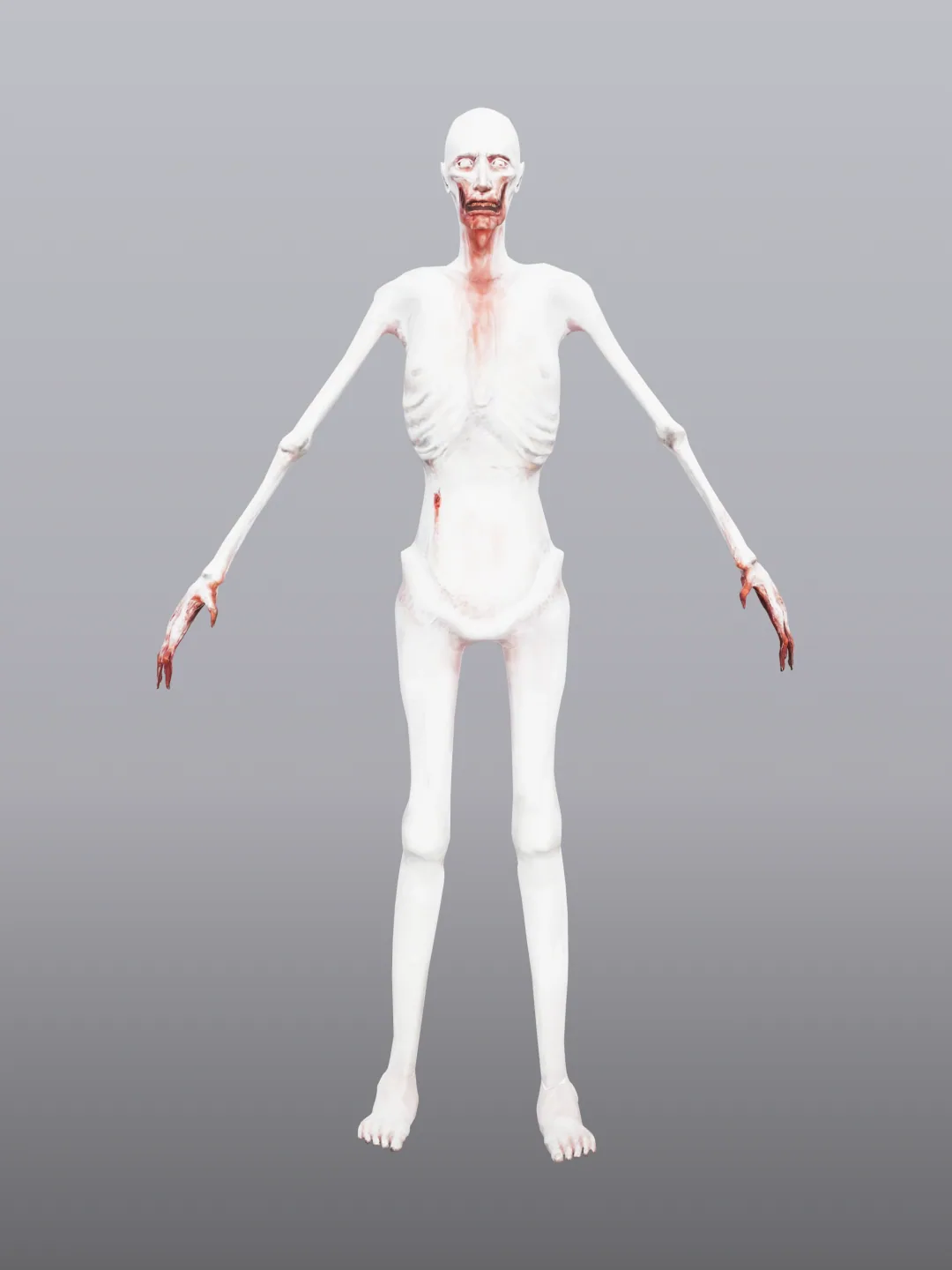 SCP-096